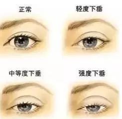 https://img.miyanlife.com/mnt/timg/180319/1121205210-1.jpg
