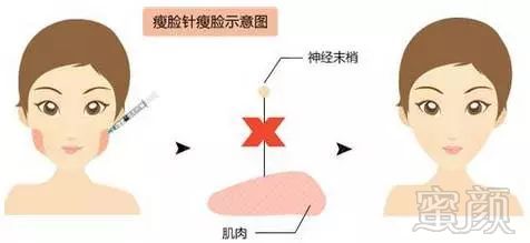 https://img.miyanlife.com/mnt/timg/180319/11251T607-9.jpg