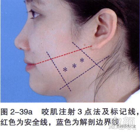 https://img.miyanlife.com/mnt/timg/180319/113Z53002-1.jpg