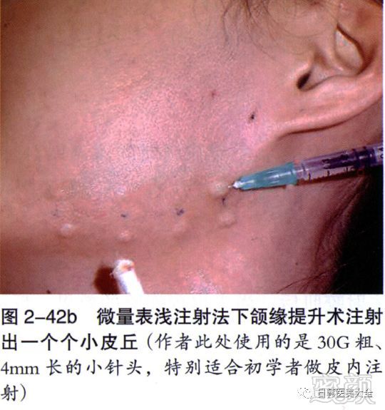 https://img.miyanlife.com/mnt/timg/180319/113Z61293-7.jpg