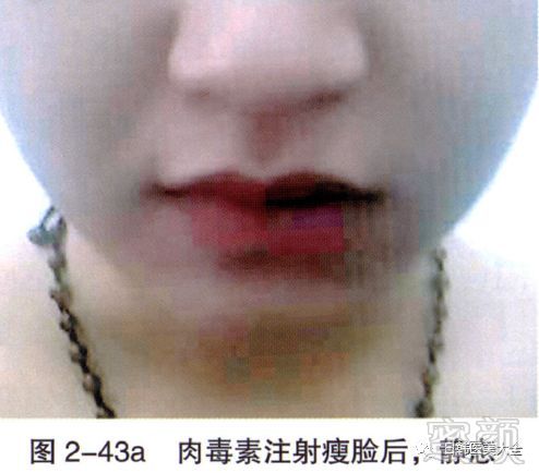 https://img.miyanlife.com/mnt/timg/180319/113ZHQ1-8.jpg