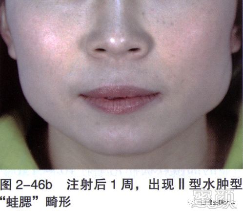 https://img.miyanlife.com/mnt/timg/180319/113ZQ337-13.jpg