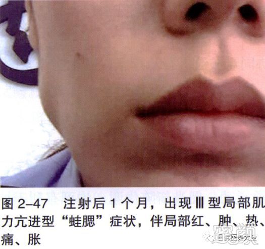 https://img.miyanlife.com/mnt/timg/180319/113ZS037-15.jpg