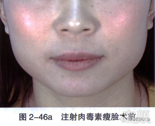 https://img.miyanlife.com/mnt/timg/180319/113ZWZ2-12.jpg