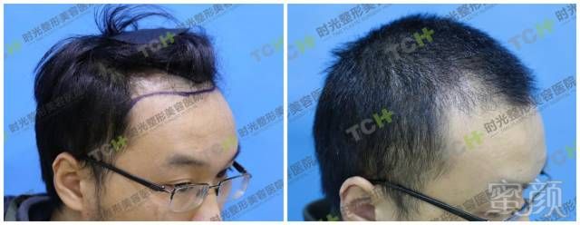 https://img.miyanlife.com/mnt/timg/180319/1140426014-11.jpg