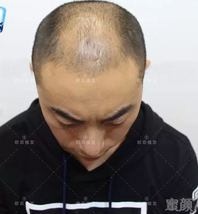https://img.miyanlife.com/mnt/timg/180319/1145302964-0.jpg