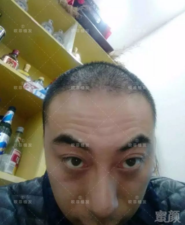 https://img.miyanlife.com/mnt/timg/180319/1145325L5-6.jpg