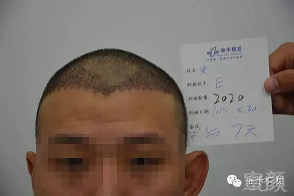 https://img.miyanlife.com/mnt/timg/180319/11453VV2-6.jpg