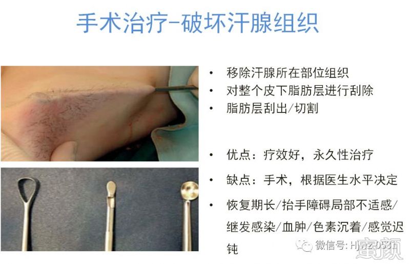 https://img.miyanlife.com/mnt/timg/180319/115G1AO-7.jpg