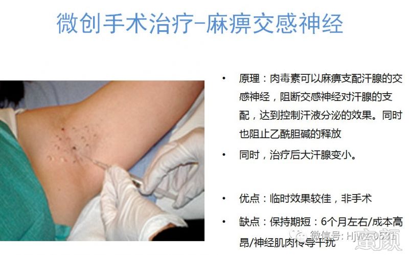 https://img.miyanlife.com/mnt/timg/180319/115G31649-10.jpg