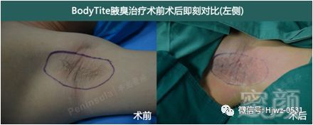 https://img.miyanlife.com/mnt/timg/180319/115G4I46-15.jpg