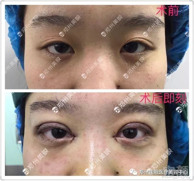 https://img.miyanlife.com/mnt/timg/180319/1200501T0-1.jpg