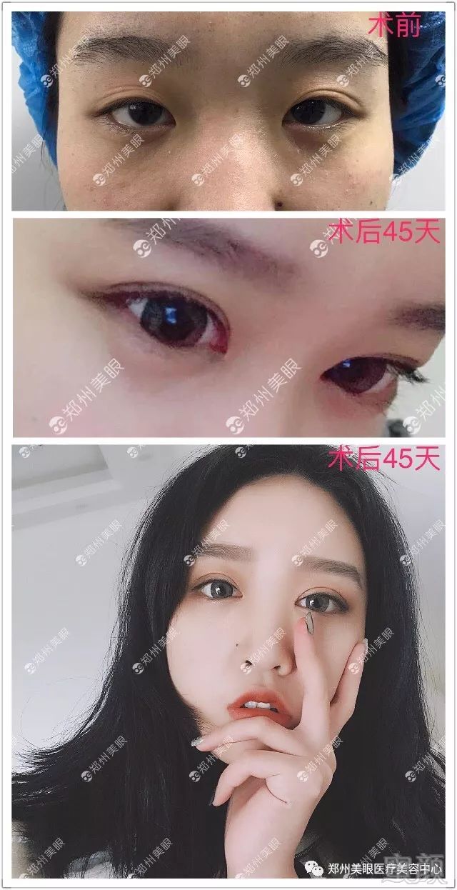 https://img.miyanlife.com/mnt/timg/180319/1200505U2-4.jpg