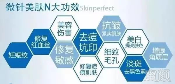 https://img.miyanlife.com/mnt/timg/180319/1201511945-2.jpg