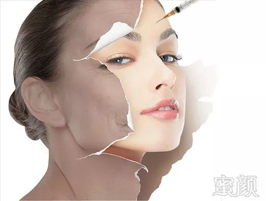 https://img.miyanlife.com/mnt/timg/180319/1225512636-8.jpg