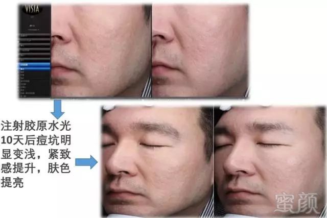 https://img.miyanlife.com/mnt/timg/180319/1225524164-12.jpg