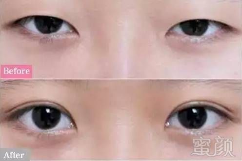 https://img.miyanlife.com/mnt/timg/180319/130J44E5-5.jpg
