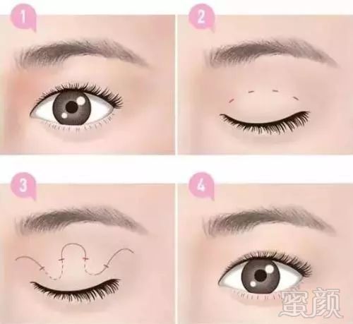 https://img.miyanlife.com/mnt/timg/180319/130Ja114-13.jpg