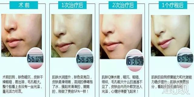 https://img.miyanlife.com/mnt/timg/180320/110045O58-10.jpg