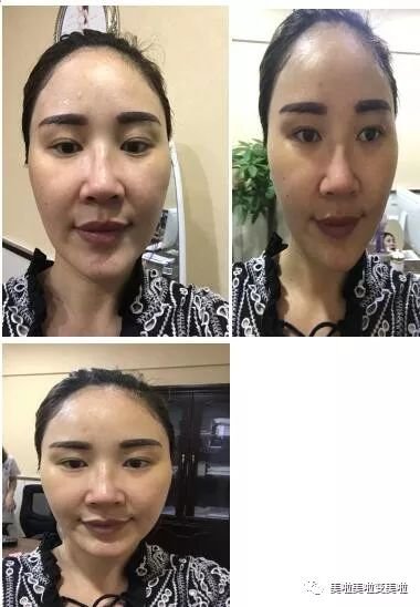 https://img.miyanlife.com/mnt/timg/180320/11441364c-1.jpg