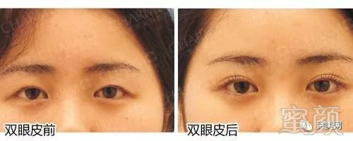 https://img.miyanlife.com/mnt/timg/180320/1149334937-1.jpg