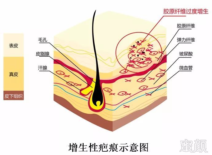 案例图片