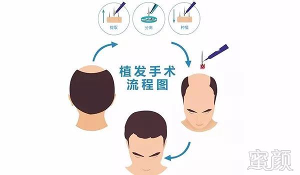 https://img.miyanlife.com/mnt/timg/180320/1214454446-2.jpg