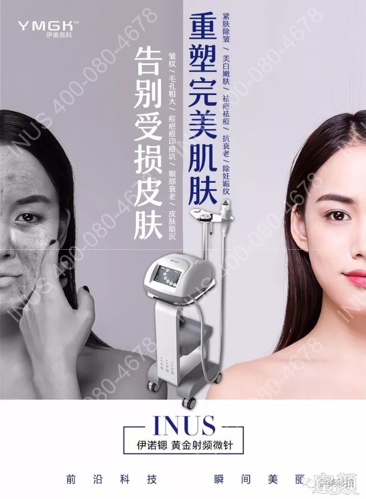 https://img.miyanlife.com/mnt/timg/180320/12250R960-5.jpg
