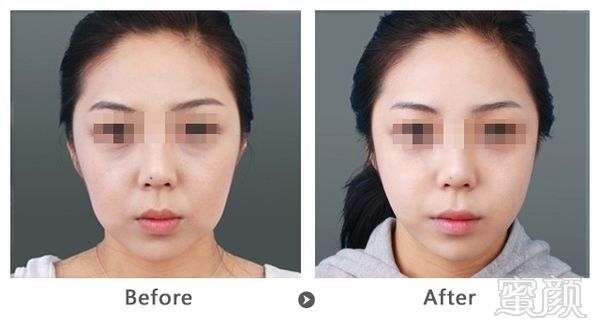 https://img.miyanlife.com/mnt/timg/180321/10423R0O-1.jpg