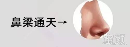 https://img.miyanlife.com/mnt/timg/180321/1045561335-2.jpg