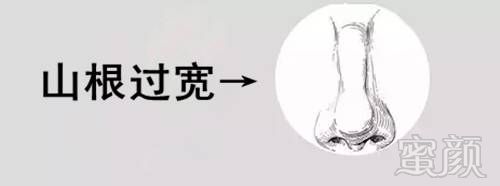 https://img.miyanlife.com/mnt/timg/180321/1045563162-1.jpg