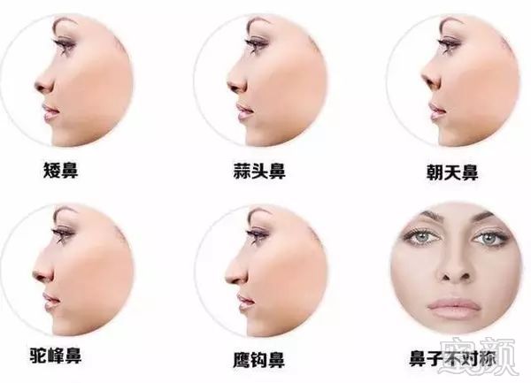 https://img.miyanlife.com/mnt/timg/180321/10455G103-5.jpg