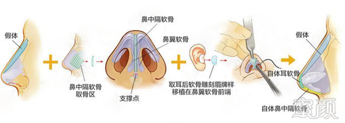 https://img.miyanlife.com/mnt/timg/180321/10463915F-3.jpg