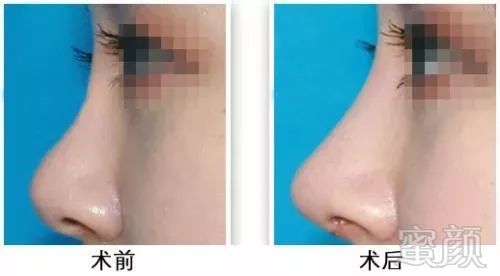 https://img.miyanlife.com/mnt/timg/180321/1053344320-2.jpg