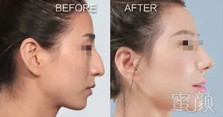 https://img.miyanlife.com/mnt/timg/180321/1053346014-0.jpg