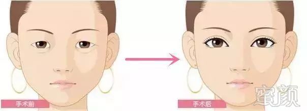 https://img.miyanlife.com/mnt/timg/180321/110344G21-5.jpg