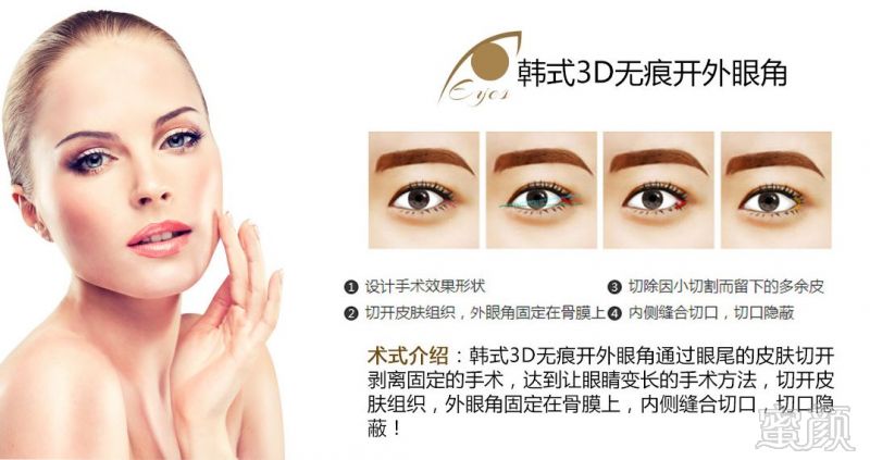 https://img.miyanlife.com/mnt/timg/180321/11034523G-9.jpg