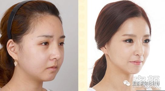 https://img.miyanlife.com/mnt/timg/180321/1114052402-7.jpg
