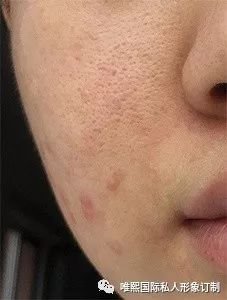 https://img.miyanlife.com/mnt/timg/180321/1122522144-3.jpg