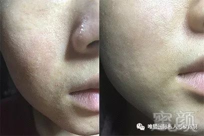 https://img.miyanlife.com/mnt/timg/180321/1122523N6-5.jpg