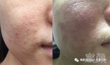 https://img.miyanlife.com/mnt/timg/180321/112252J59-4.jpg