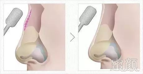 https://img.miyanlife.com/mnt/timg/180321/11244H393-6.jpg