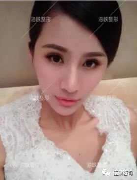 https://img.miyanlife.com/mnt/timg/180321/1135234405-3.jpg