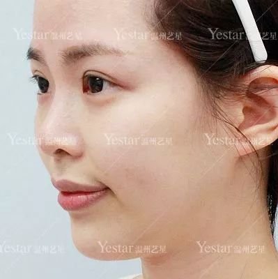 https://img.miyanlife.com/mnt/timg/180321/113R534F-4.jpg