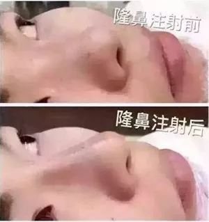 https://img.miyanlife.com/mnt/timg/180321/1146313436-11.jpg