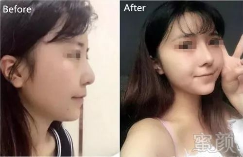 https://img.miyanlife.com/mnt/timg/180321/114631C36-12.jpg