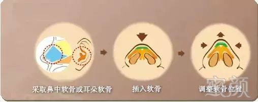 https://img.miyanlife.com/mnt/timg/180321/114F453b-12.jpg