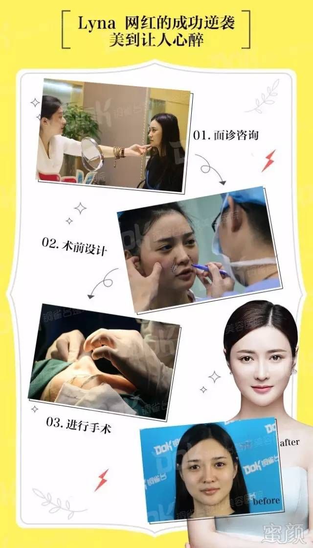 https://img.miyanlife.com/mnt/timg/180321/1155455J7-4.jpg
