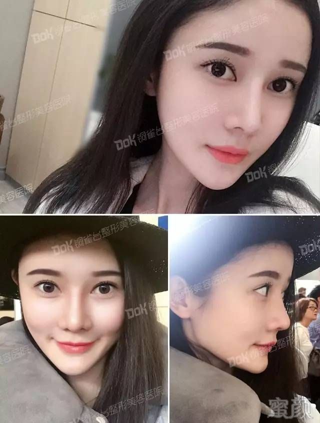 https://img.miyanlife.com/mnt/timg/180321/11554L006-7.jpg