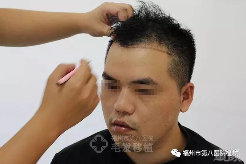 https://img.miyanlife.com/mnt/timg/180321/115J92442-1.jpg